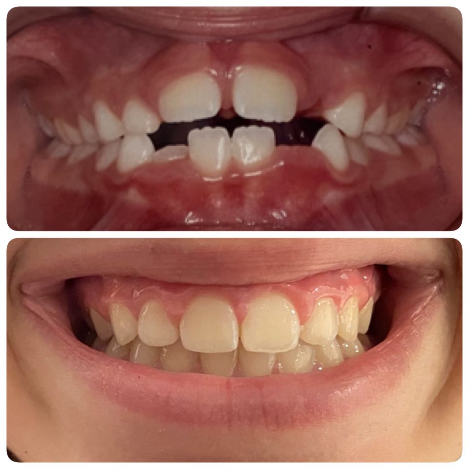 DENTES01