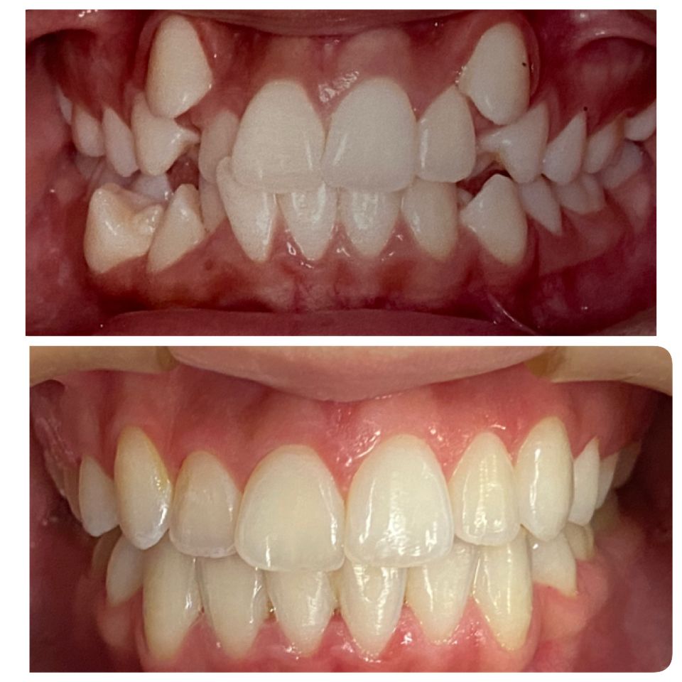 DENTES02